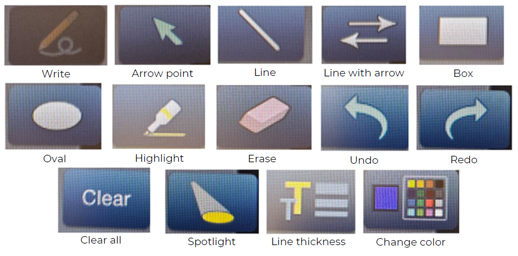 Annotation Buttons